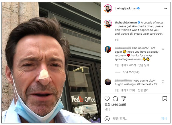 피부암에 걸린 배우 휴잭맨은 자신의 SNS에서 자외선 차단제 사용을 강조했다. [사진=휴잭맨 인스타그램]